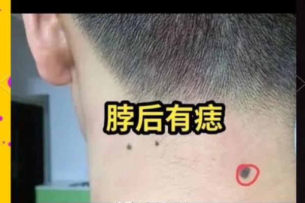 苦情痣头婚必离婚 苦情痣预示头婚必离婚真相揭秘与化解方法