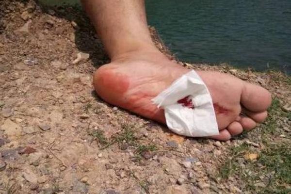 梦见砍人出血是什么预兆解梦