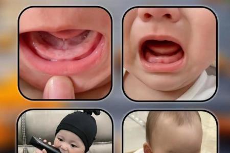 妈妈梦见孩子长牙齿什么意思