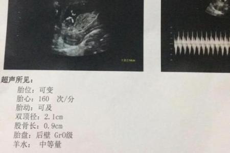 老公做梦梦到我生了个男孩